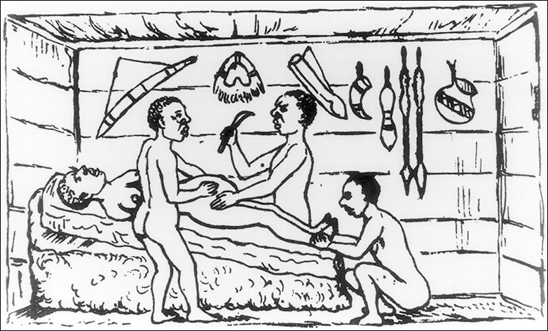 Successful Cesarean section