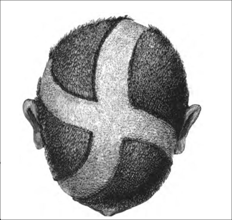 The scalp of a Ja-luo man with a pattern shaved upon it. (After Hobley.)