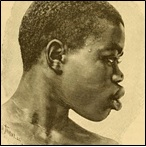 Shilluk type