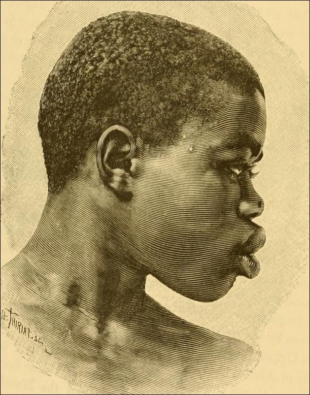Shilluk type